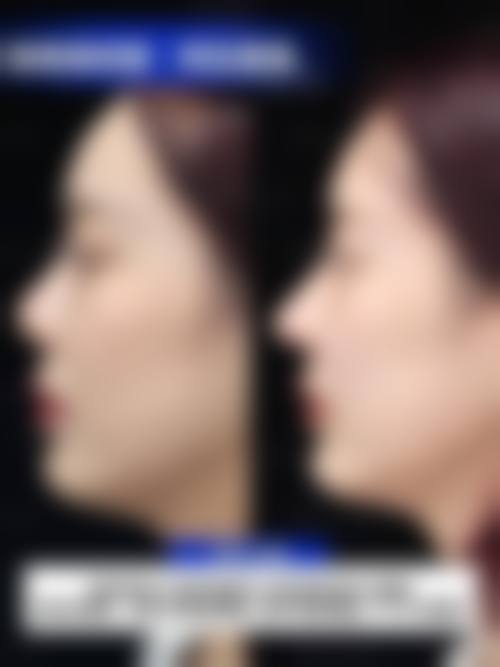 武汉维纳斯医疗整形医院怎么样特色项目及技术优势