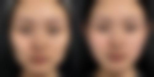 长沙雅瑷医疗美容医院怎么样简介概述