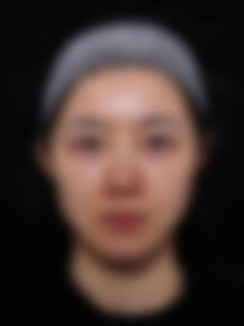 承德名媛整形医疗美容门诊部怎么样价格收费