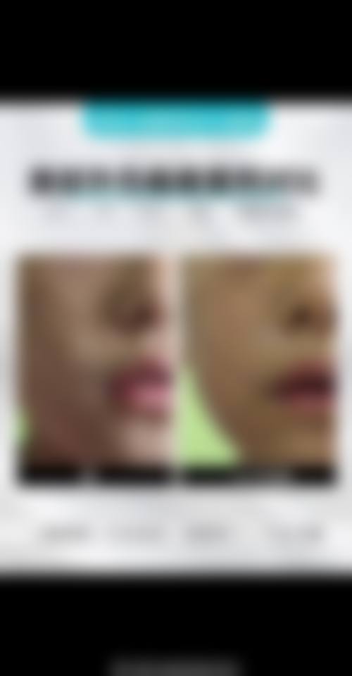 潍坊益都中 心医院烧伤整形外科怎么样基本信息