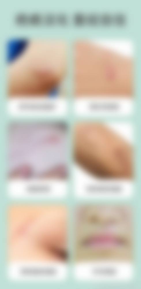 潍坊益都中 心医院烧伤整形外科怎么样价格收费