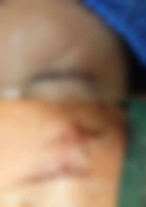 潍坊益都中 心医院烧伤整形外科怎么样简介概述