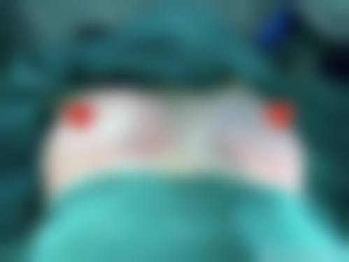 靖江市莱美整形美容诊所怎么样医生团队实力