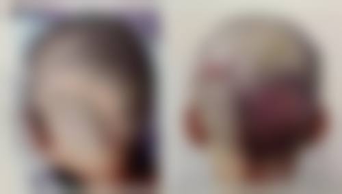 武汉武总华科植发专科医院怎么样求美者反馈