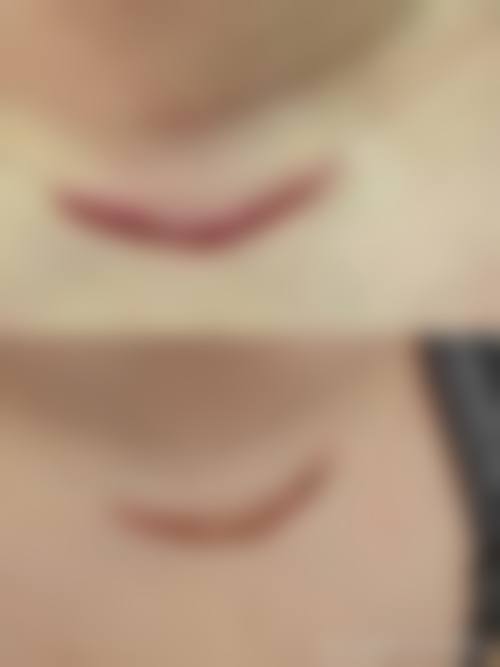 武汉武总华科植发专科医院怎么样价格收费