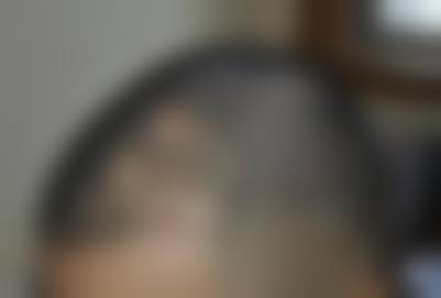 南京领秀植发医院怎么样简介概述