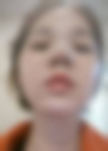 高恩世上整形外科医院怎么样来院路线