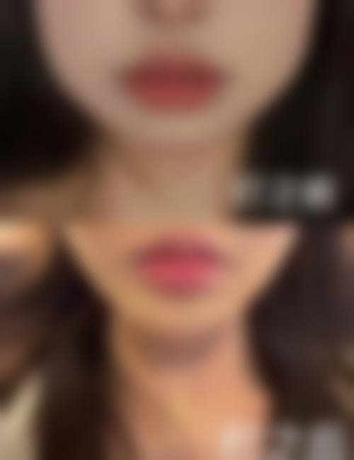 阜南县人民医院(烧伤整形科)怎么样简介概述