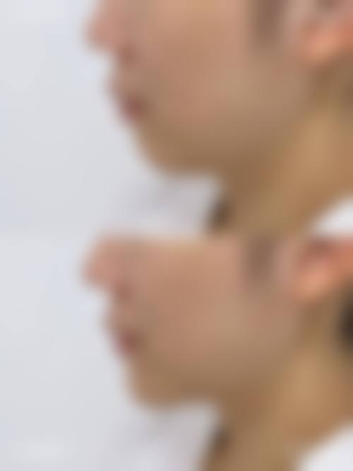 广州博仕整形怎么样来院路线