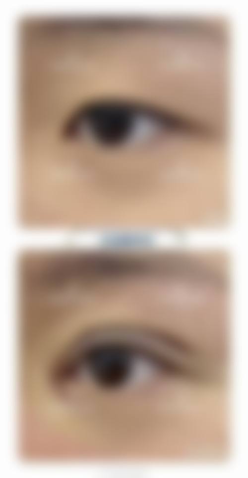 北京王府井整形美容中 心怎么样求美者反馈