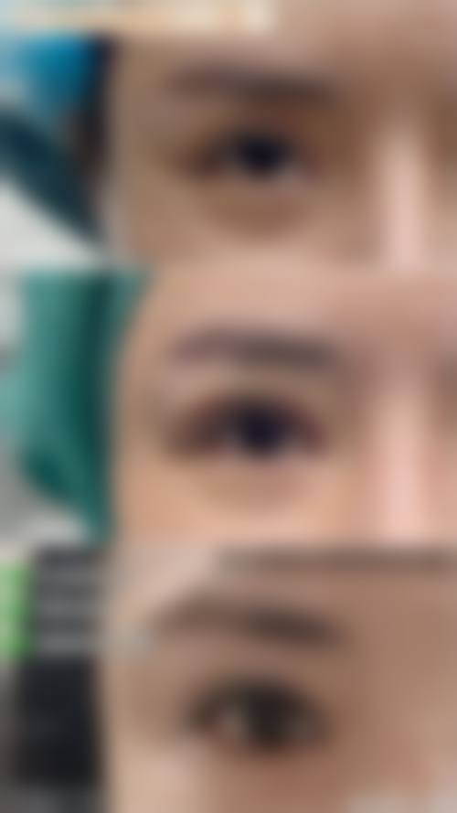 广州博仕整形怎么样价格收费