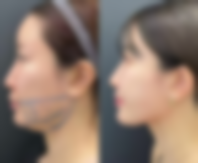 武汉维纳斯医疗整形医院怎么样来院路线