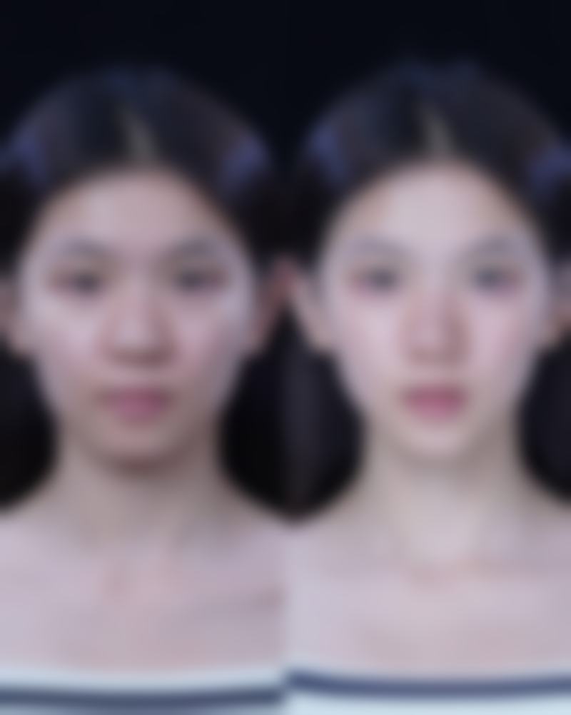 长沙晶肤医疗整形美容上市连锁机构怎么样价格收费