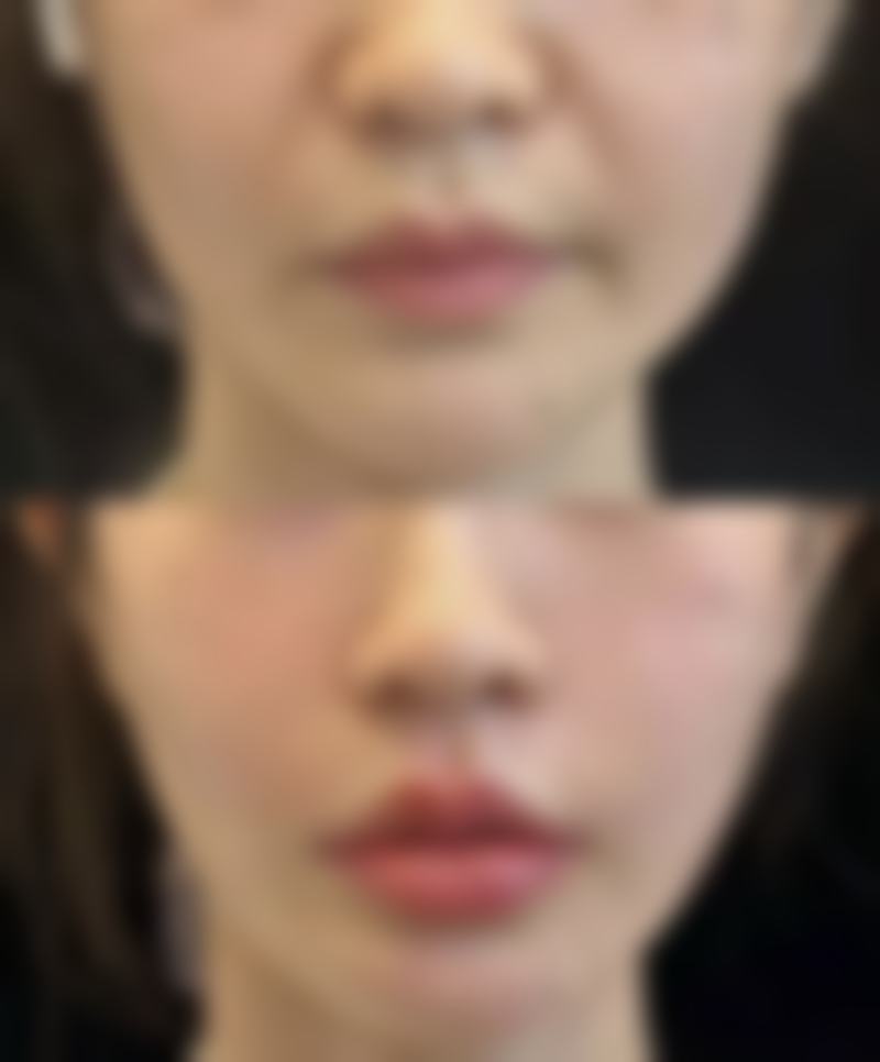 北京赵玉明整形医院怎么样特色项目及技术优势