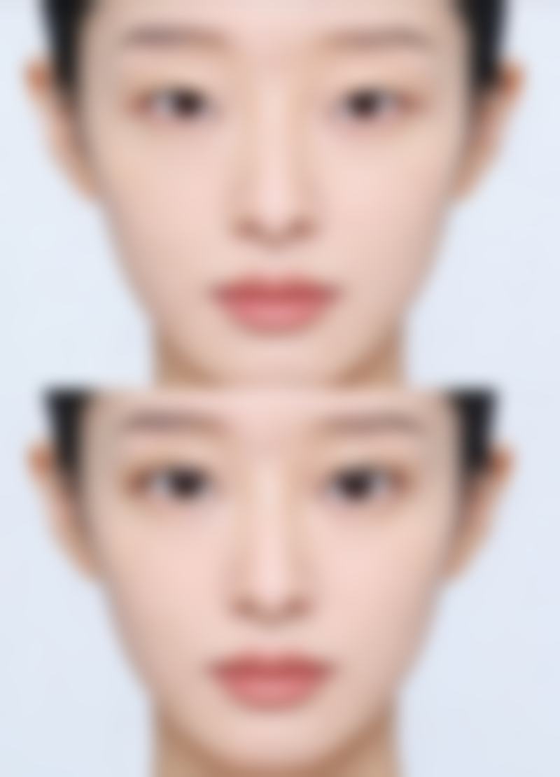 北京赵玉明整形医院怎么样价格收费