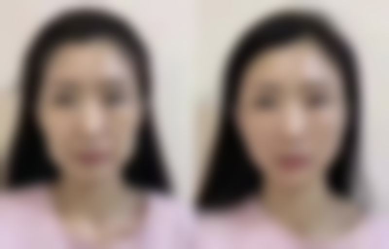 长沙晶肤医疗整形美容上市连锁机构怎么样求美者反馈