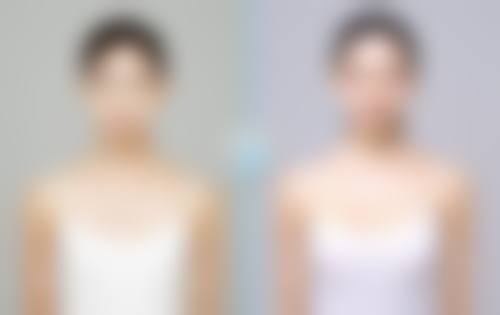 王桂芹医生的半恒久与脱毛技艺