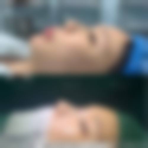 上海悦美整形医疗美容诊所怎么样求美者反馈