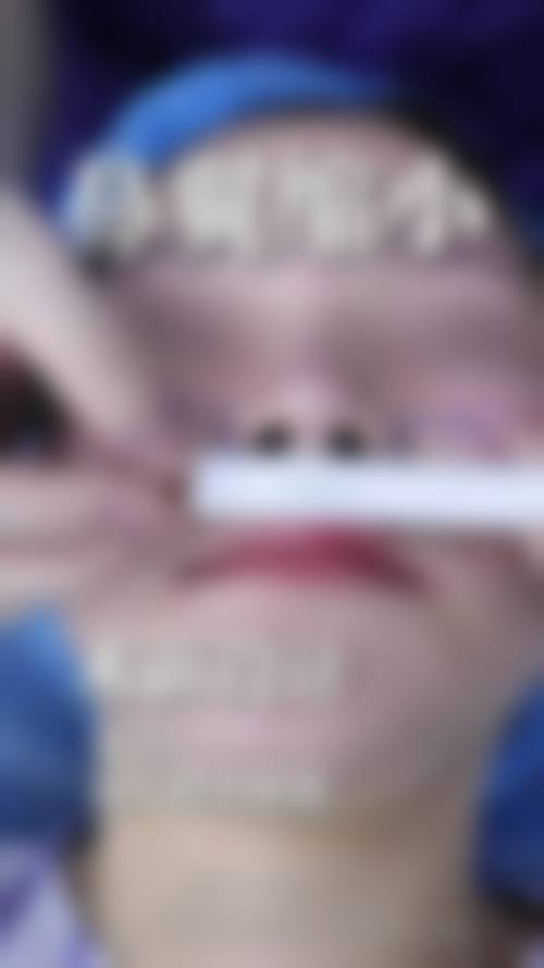 成都恒博整形美容医院怎么样特色项目及技术优势