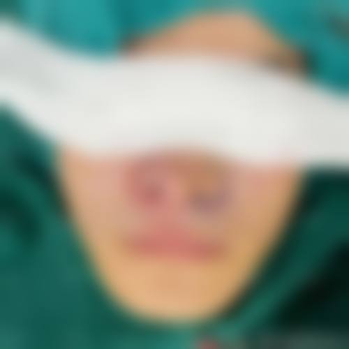 成都恒博整形美容医院怎么样求美者反馈