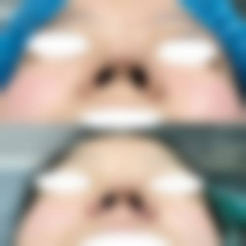 王桂芹医生的特色技术:RDS系列治疗