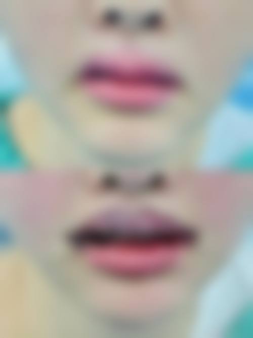 永州星雅医疗美容门诊部怎么样医生团队实力