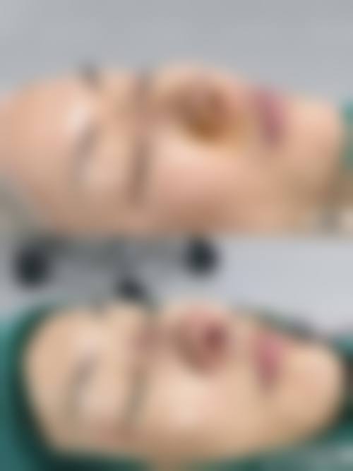 株洲河西华美整形怎么样价格收费