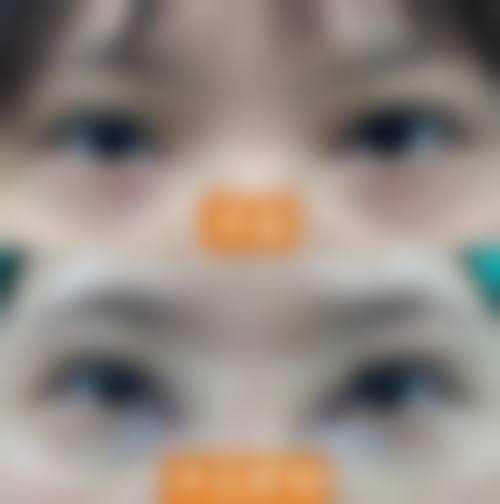 成都恒博整形美容医院怎么样价格收费