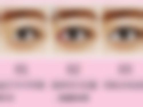 成都恒博整形美容医院怎么样来院路线