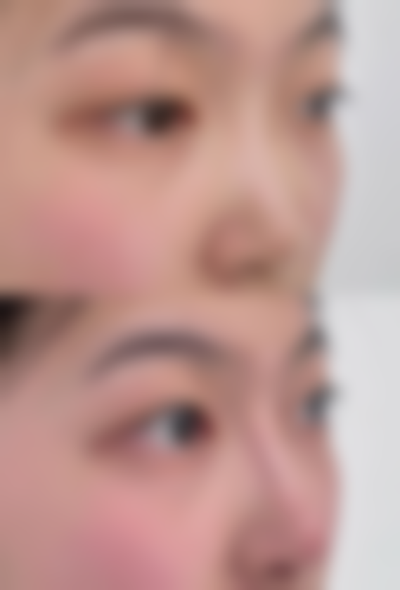 上海悦美整形医疗美容诊所怎么样特色项目及技术优势