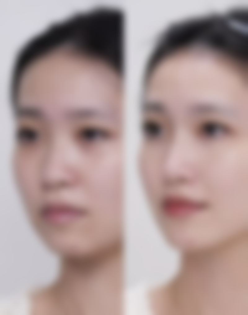 东莞美熙伊美整形医疗美容门诊部怎么样医生团队实力