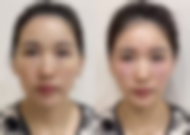 徐彬医生负责范围的合理价格