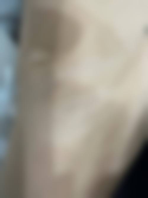 湘南美容外科 新宿本院怎么样求美者反馈