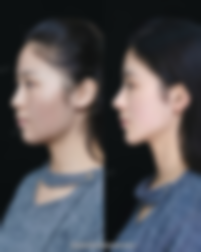 胡东浩医生助您重拾口腔健康