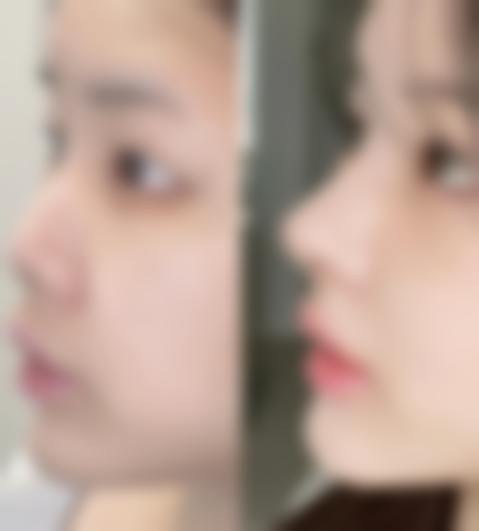 胡东浩医生的专精优势