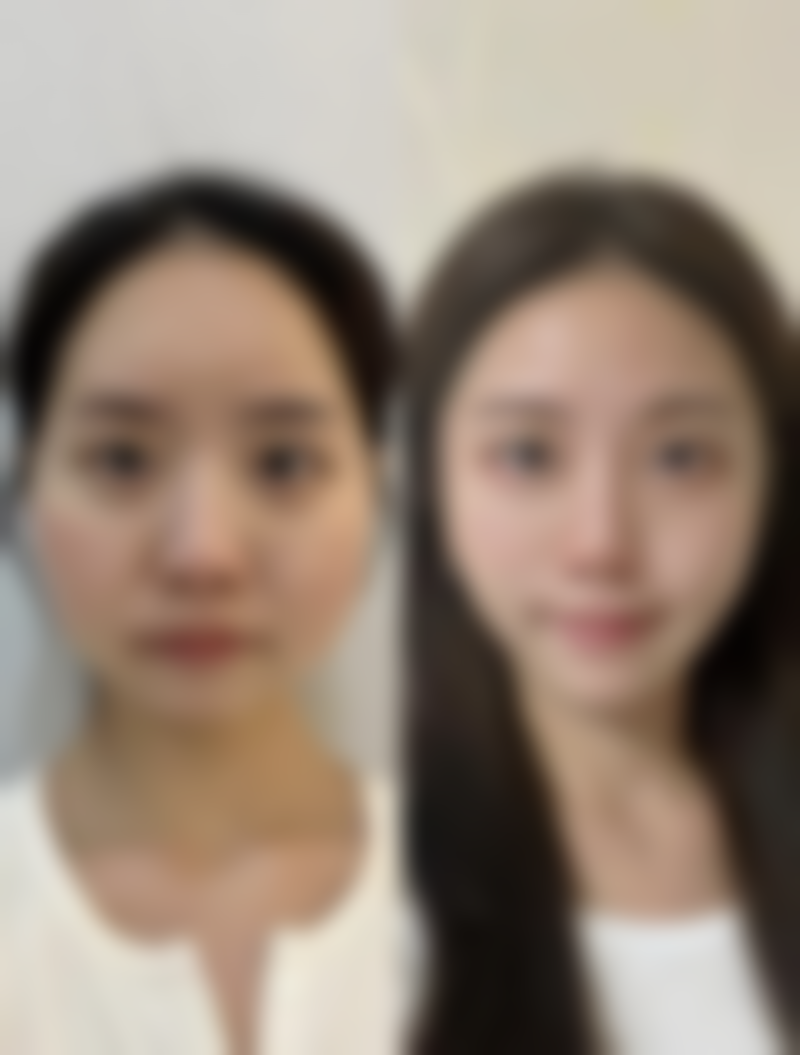 易南方医生带来的美丽蜕变实例