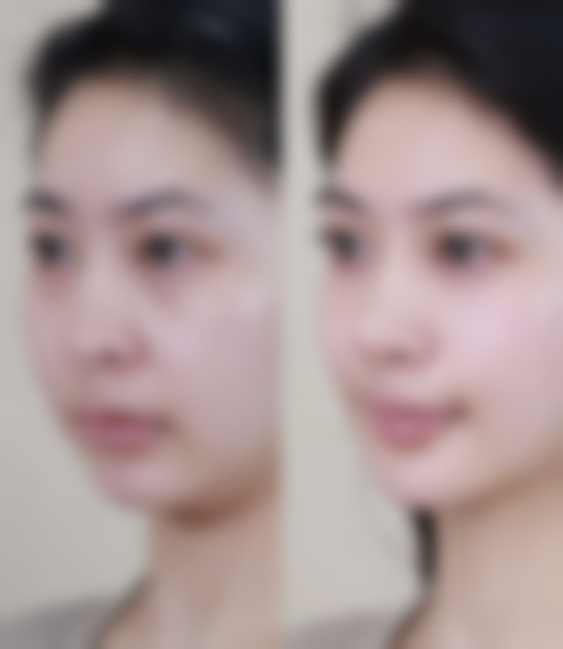 胡东浩医生的患者口碑