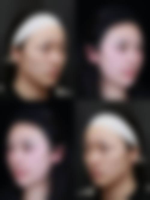 红河哈尼族彝族自治州蒙自白天鹅医疗美容门诊部怎么样求美者反馈