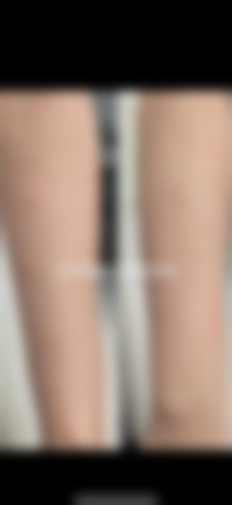 专精技术优势：欧阳山蓓的整形保护