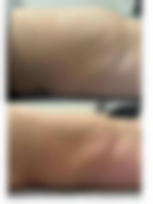 任玲仪医生的擅长领域