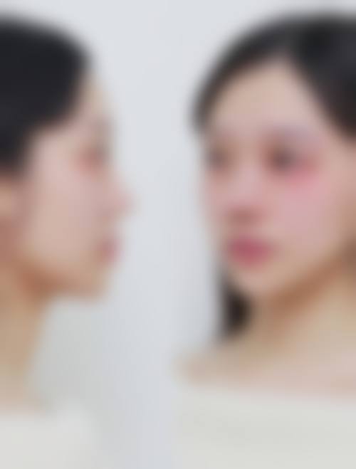 太仓广慈医院整形美容科怎么样来院路线