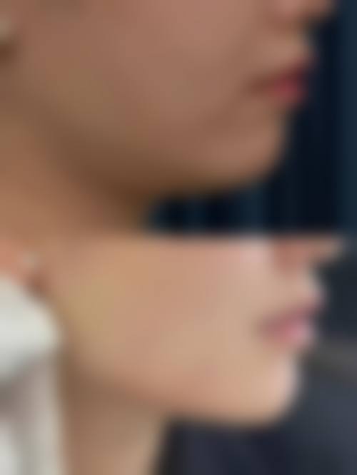 朴圣哲医生的价格与询问