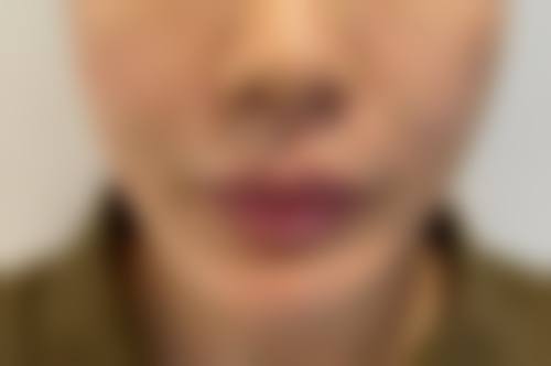 朴圣哲院长的美体塑形秘籍