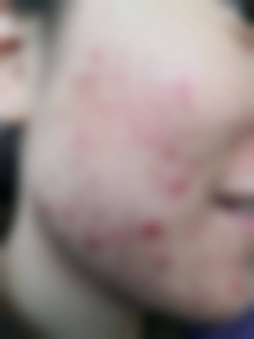 重庆市南川区人民医院皮肤美容科怎么样来院路线