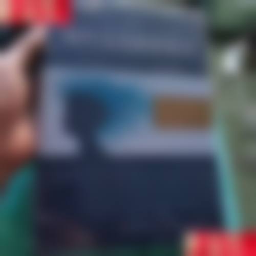 韩国forhair毛发移植中 心医院怎么样求美者反馈