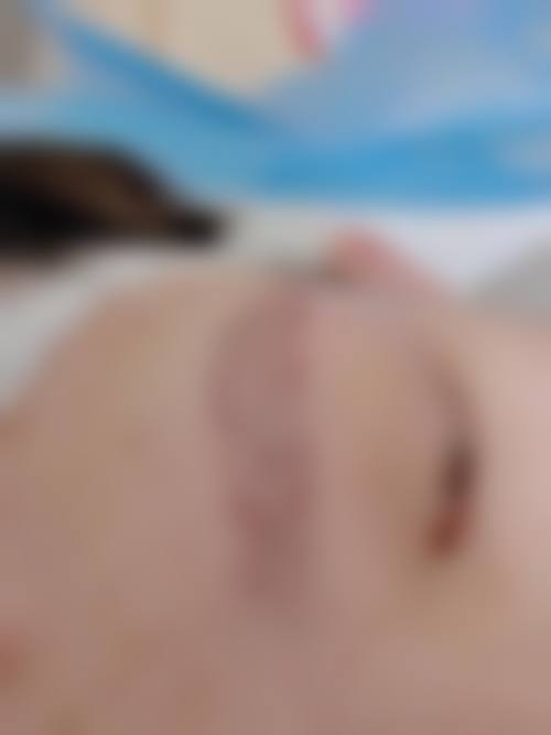 韩国forhair毛发移植中 心医院怎么样来院路线