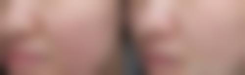 金芝娥医生的精良技术保护