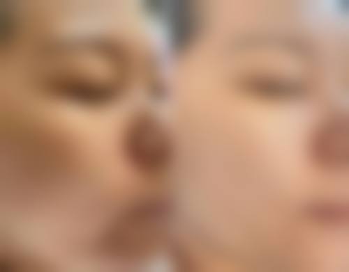 金芝娥医生的成功实例展示