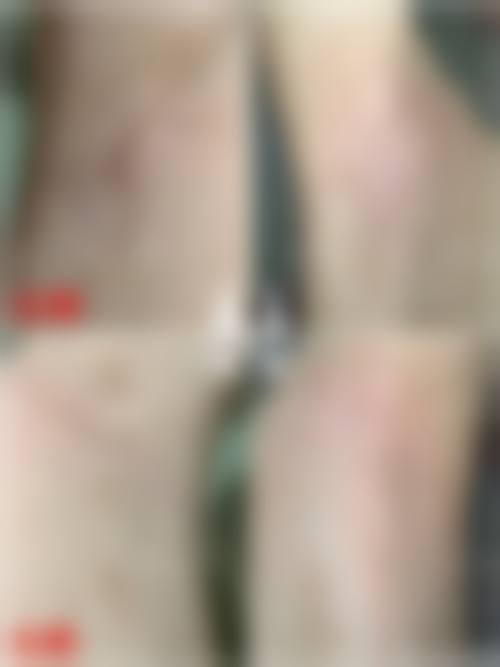 朴圣哲医生擅长的整形领域