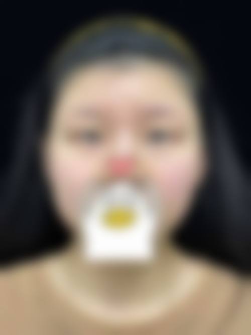 福州华仁医疗整形美容医院怎么样价格收费